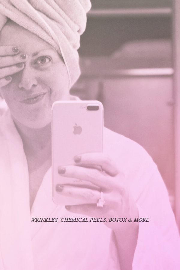 Tales from the dermatologist. Get all the deets on botox, microdermabrasion, chemical peels, IPL and more.